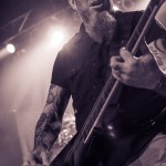 Anthrax