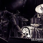 Child Bite-band-007