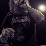 Child Bite-band-009