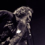 Child Bite-band-016